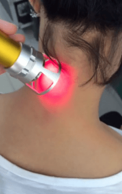 Terapia con láser