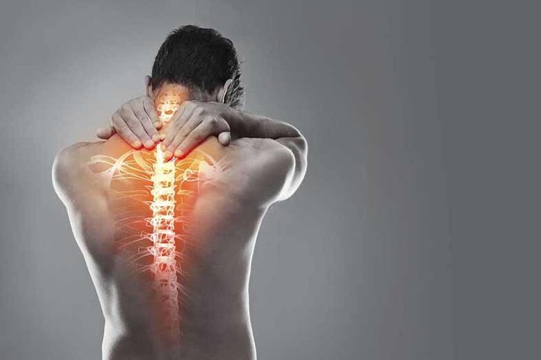 Osteocondrose da rexión cervical