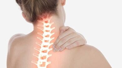 As principais manifestacións da osteocondrose cervical