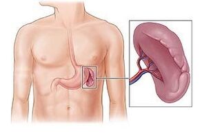 patoloxía do bazo como causa de dor baixo o omóplato esquerdo